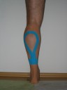 Kinesio-Tape