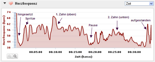 Puls Weisheitszähne